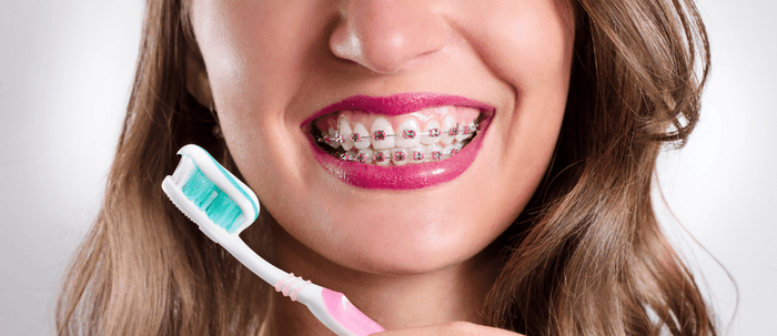 How To Brush Your Teeth With Braces Using An Electric Toothbrush