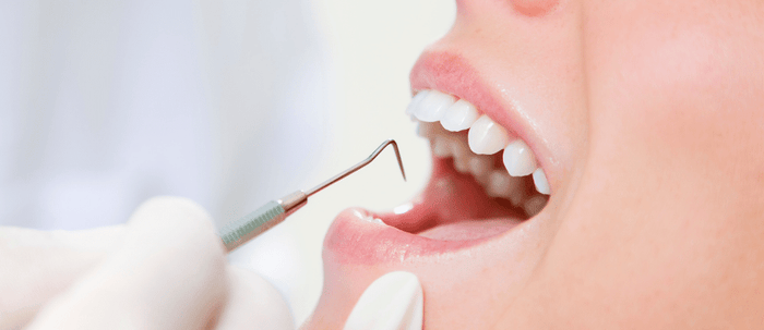 How To Remove Tartar From Your Teeth Without A Dentist