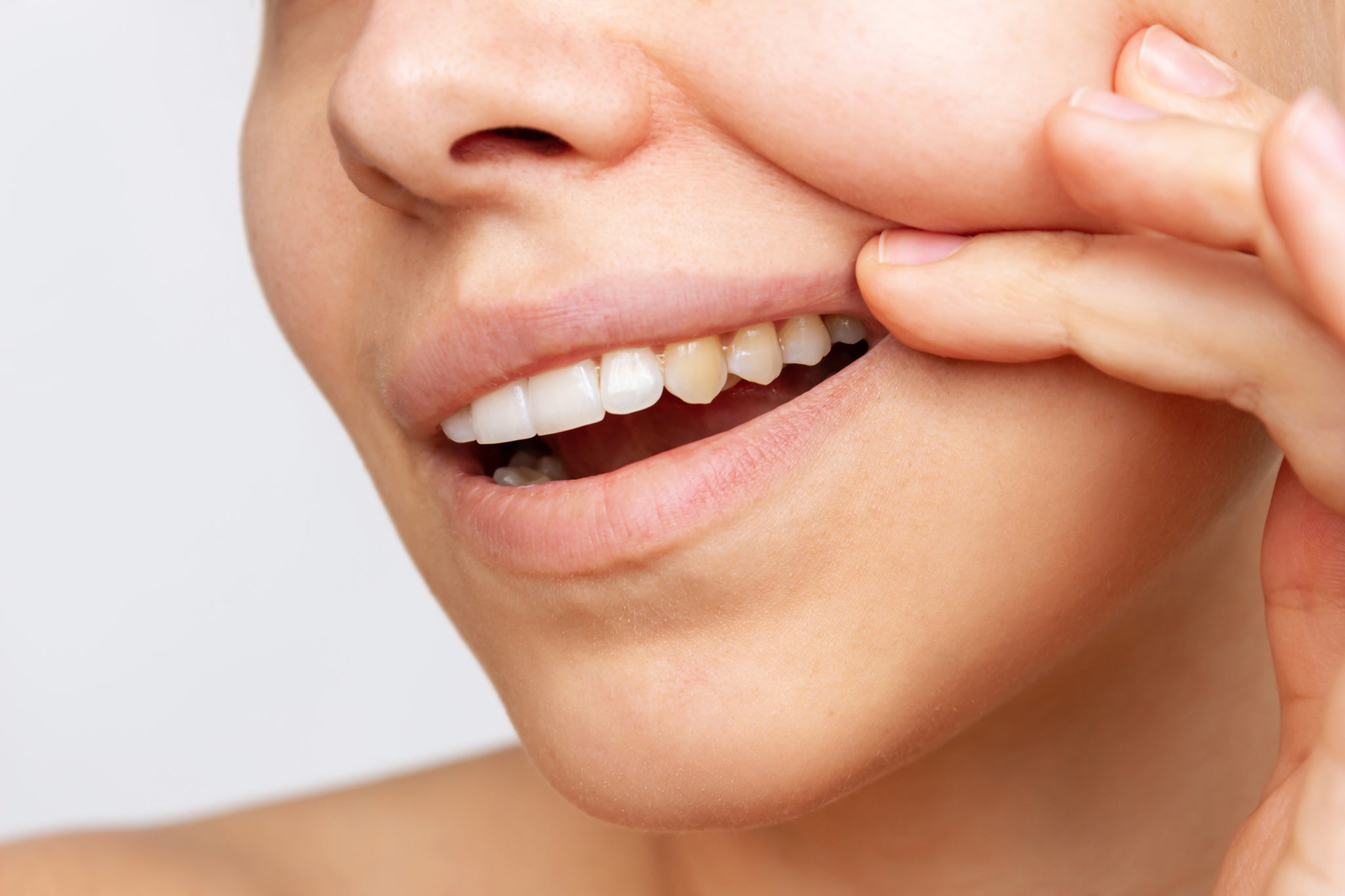 The Causes and Solutions for Tooth Discolouration